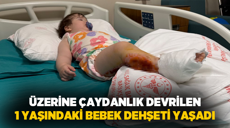 İstanbul’da babaannesi mutfakta yemek yaptığı sırada üzerine kaynar çaydanlık devrilen