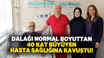  Denizli Devlet Hastanesi’nde dalağı normalden yaklaşık 40 kat büyük olan