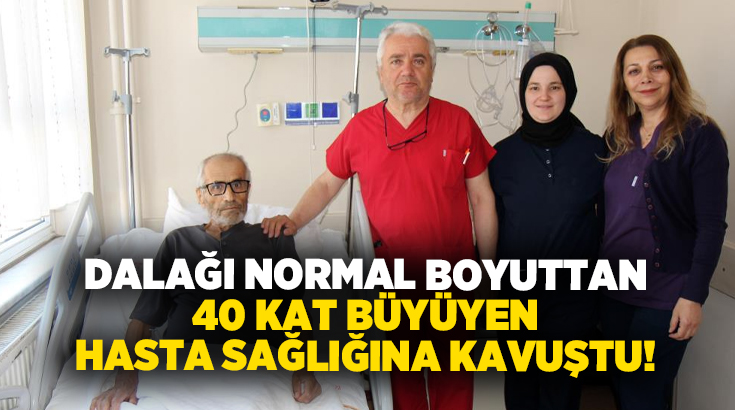  Denizli Devlet Hastanesi’nde dalağı normalden yaklaşık 40 kat büyük olan